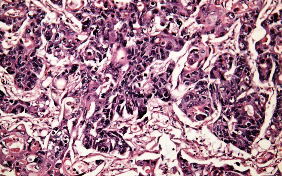 Cell-Based Multi-Target QSAR Model for Design of Virtual Versatile Inhibitors of Liver Cancer Cell Lines